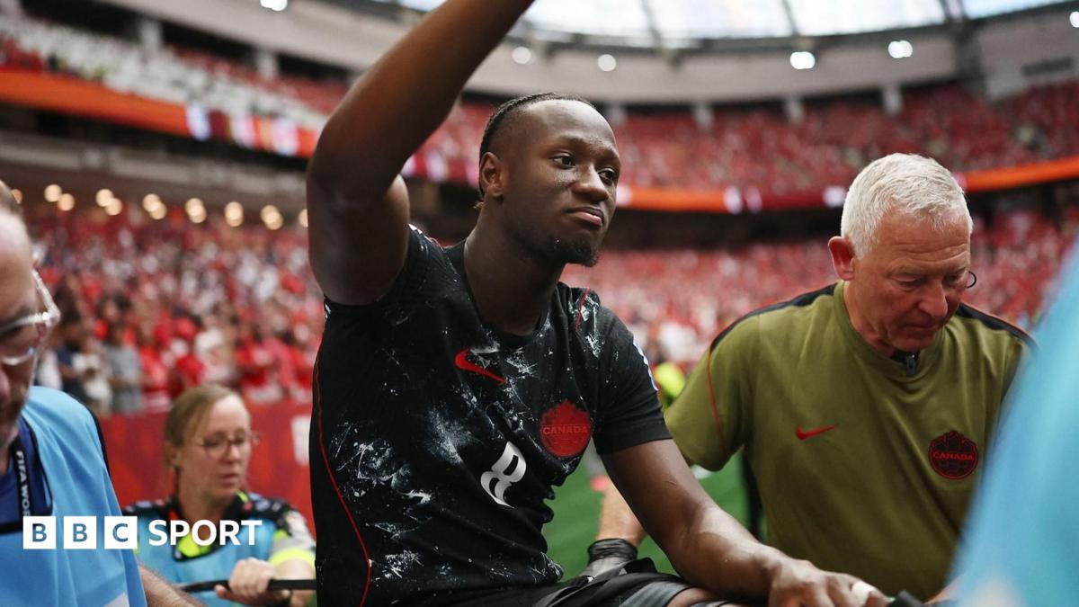 Ismael Koné operohet pas thyerjes së këmbës  falënderon shokët dhe tifozët