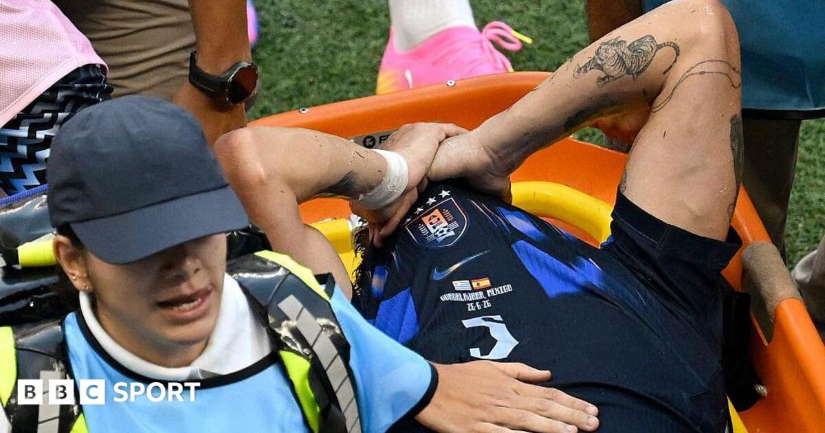 ligamentit të gjurit