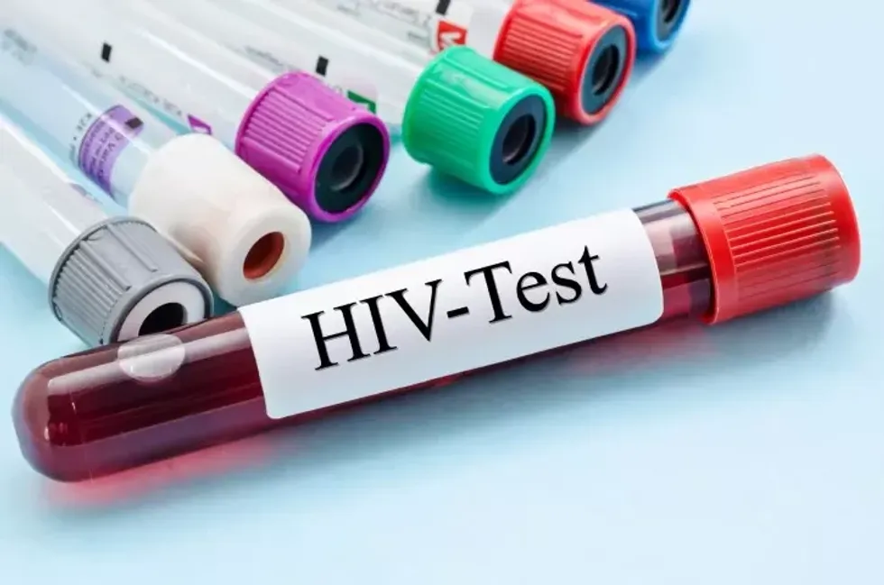 Dhjetë raste të reja me HIV në muajt e fundit  dy viktima   rritet testimi vullnetar