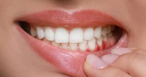 20 shenja alarmante që tregojnë se duhet të shkoni te dentisti
