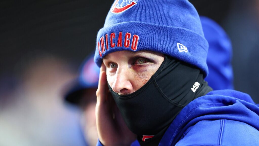 Alex Bregman përshkruan lëndimet e rënda në fytyrë   Jam shumë me fat që nuk ishte më keq 