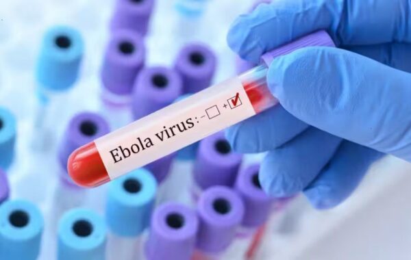 të konfirmuara me Ebola