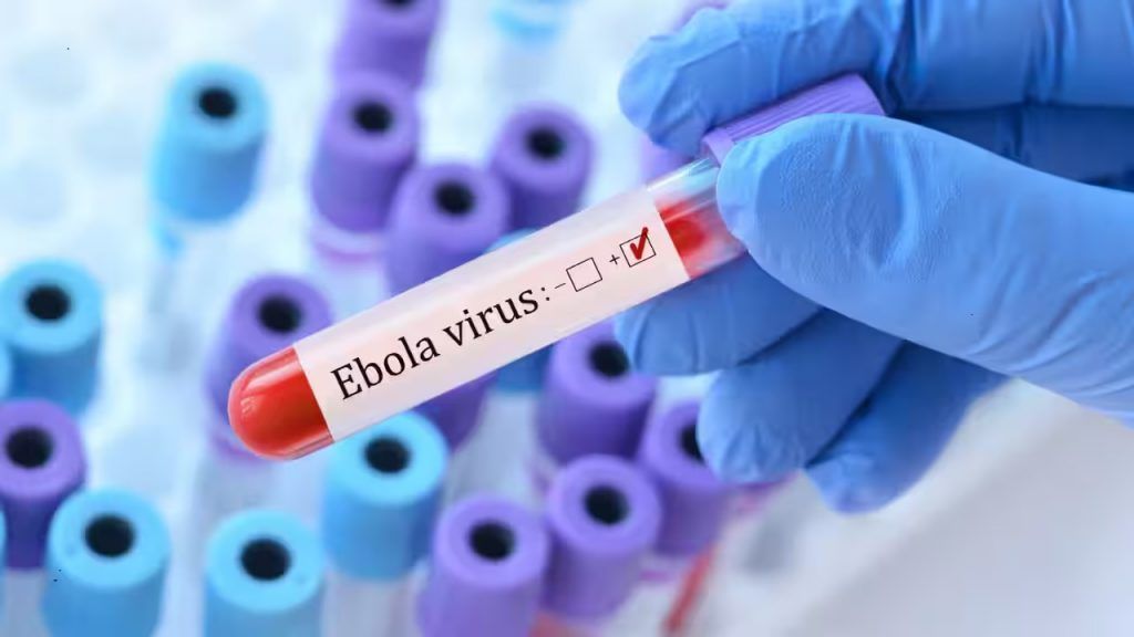 të konfirmuara me Ebola
