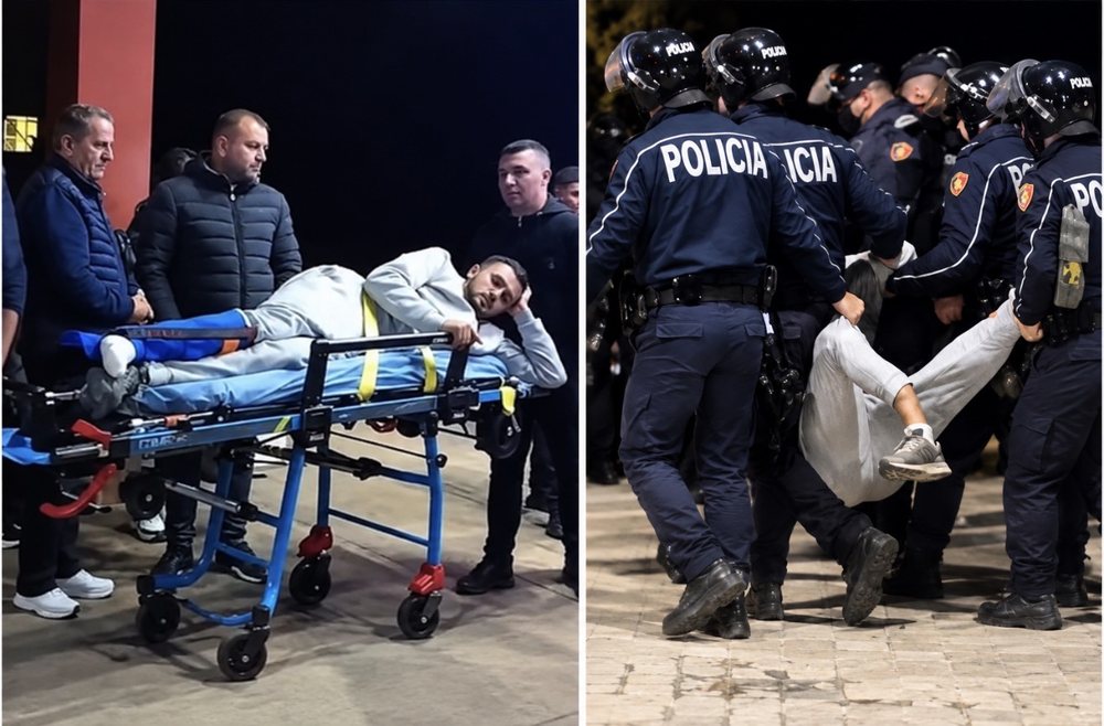 Protesta  Ministria e Shëndetësisë  6 të lënduar te  Trauma   njëri po i nënshtrohet operacionit