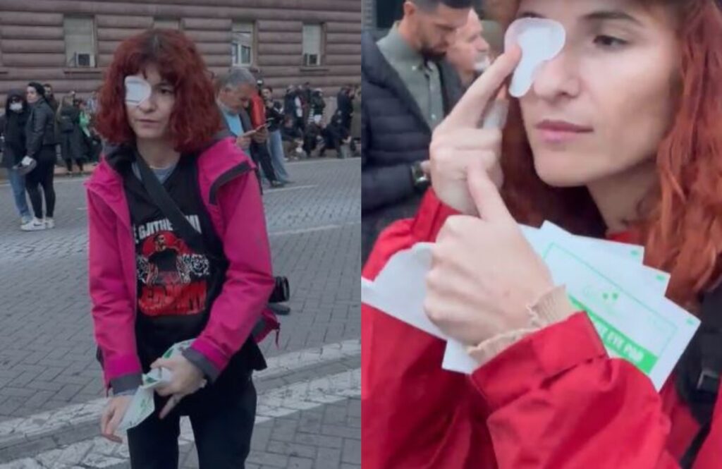 Solidaritet për Erjon Vishkullin  protestuesit shpërndajnë leukoplaste për sytë  VIDEO 